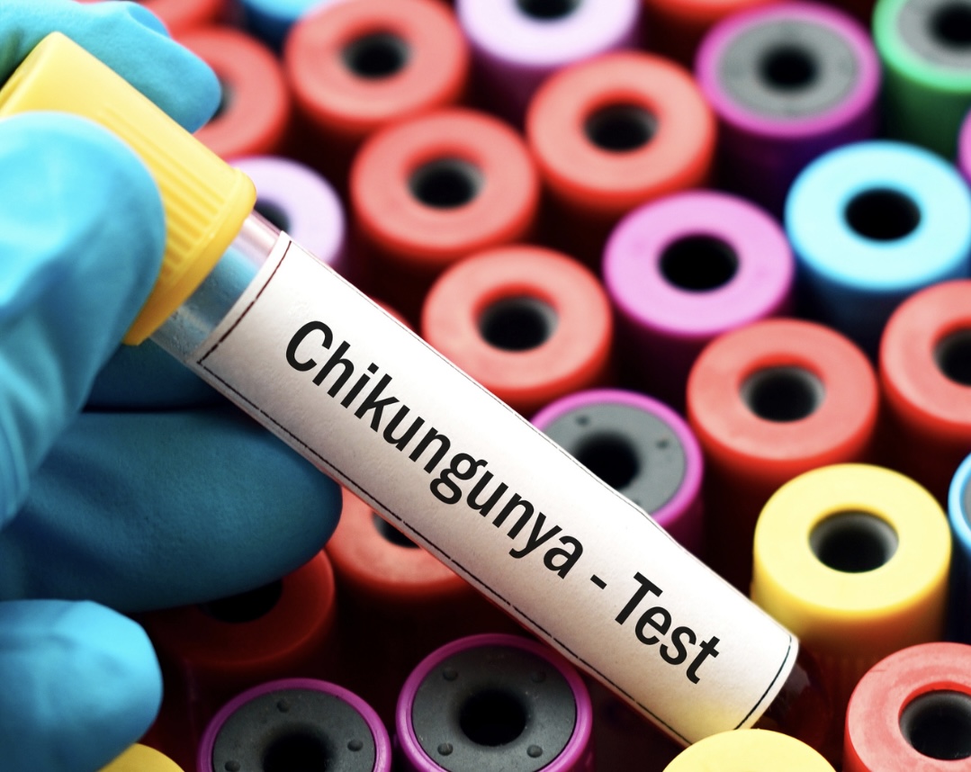 Copia de Le robaron la bicicleta a